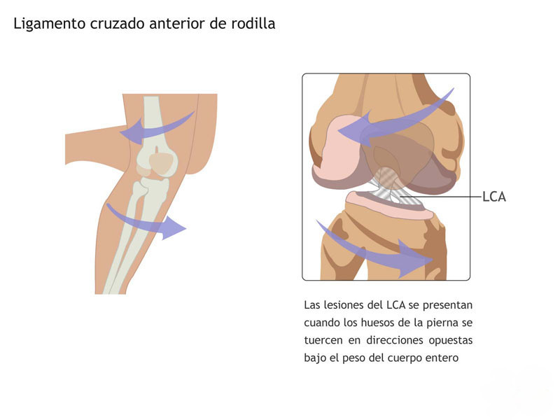 Ligamento Cruzado Anterior