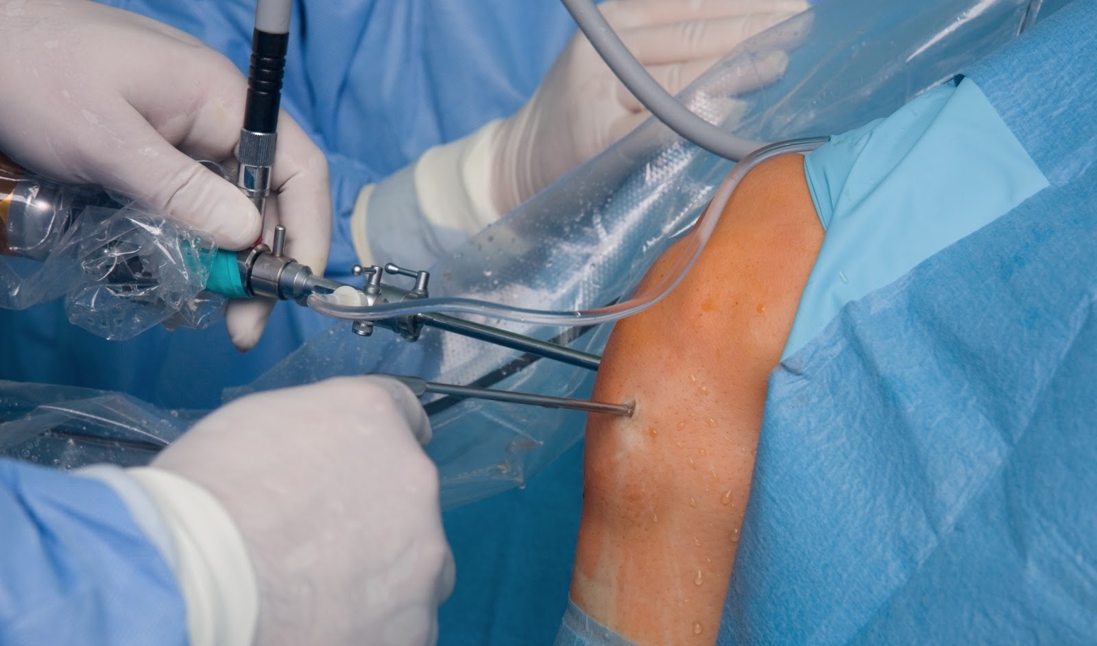 Procedimiento Quir�rgico m�s frecuente